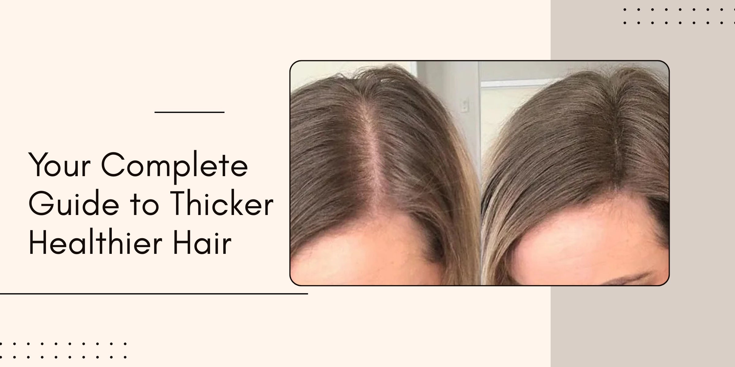 How to Boost Hair Density: Your Complete Guide to Thicker, Healthier Hair