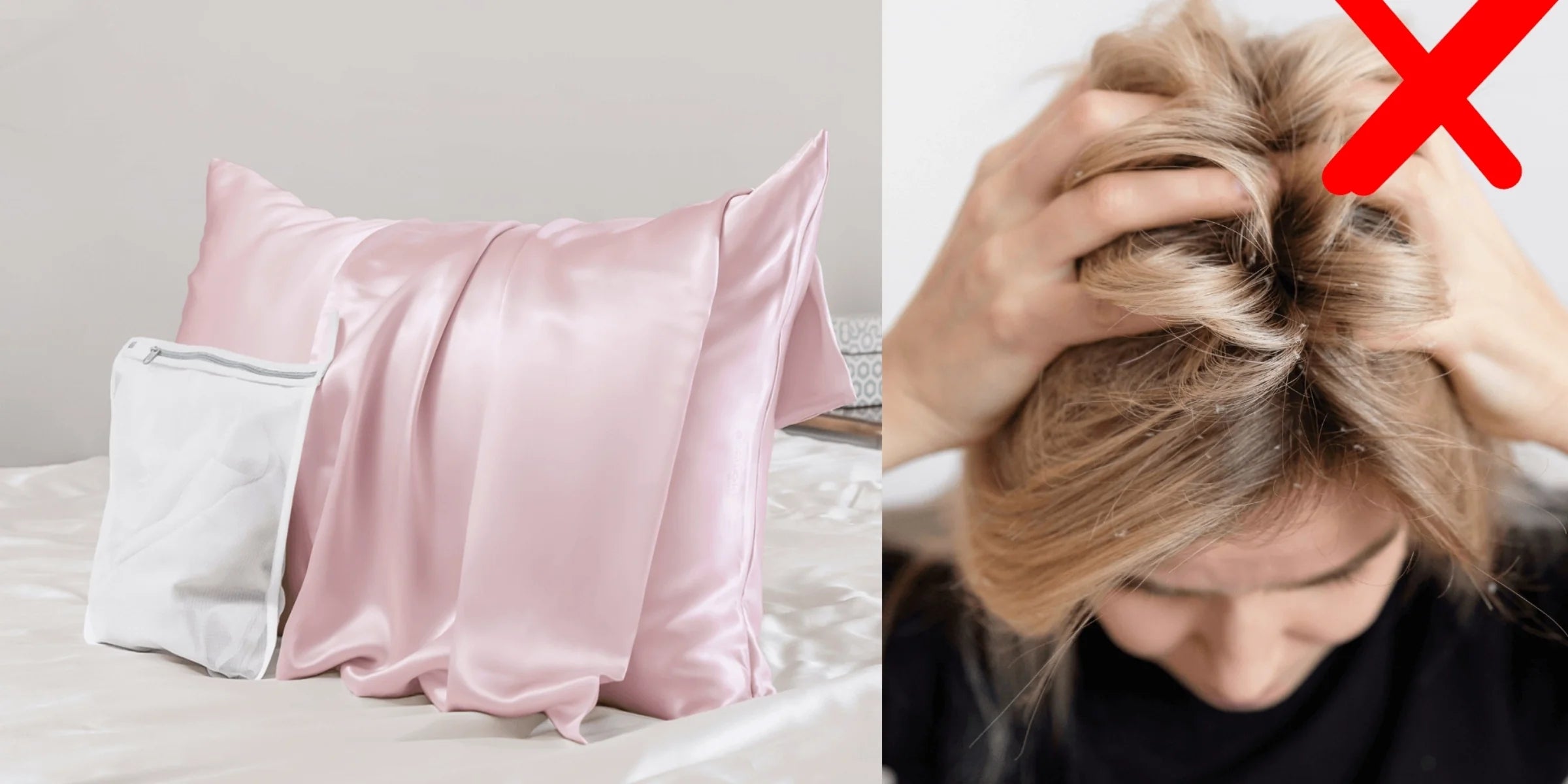 Itchy Scalp at Night? Reasons & How a Silk Pillowcase Helps